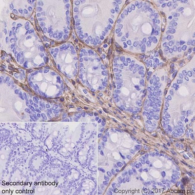 Immunohistochemistry (Formalin/PFA-fixed paraffin-embedded sections) - Anti-Periostin antibody [EPR20806] (AB215199), expandable thumbnail