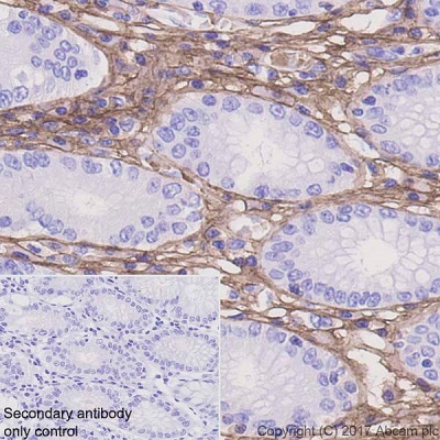 Immunohistochemistry (Formalin/PFA-fixed paraffin-embedded sections) - Anti-Periostin antibody [EPR20806] (AB215199), expandable thumbnail