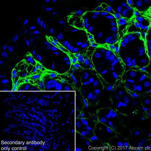 Immunohistochemistry (Frozen sections) - Anti-Periostin antibody [EPR20806] (AB215199)
