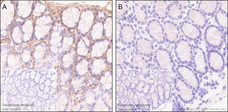 Immunohistochemistry (Formalin/PFA-fixed paraffin-embedded sections) - Anti-Periostin antibody [EPR20806] - BSA and Azide free (AB227049)
