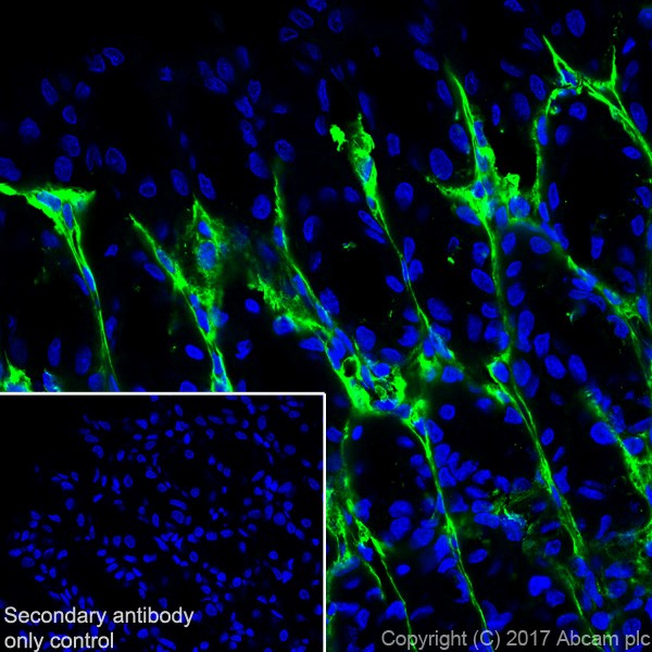 Immunohistochemistry (Frozen sections) - Anti-Periostin antibody [EPR20806] - BSA and Azide free (AB227049), expandable thumbnail
