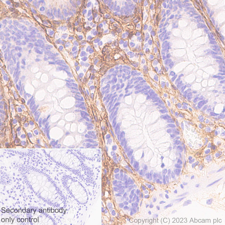 Immunohistochemistry (Formalin/PFA-fixed paraffin-embedded sections) - Anti-Periostin antibody [RM1074] (AB315104)