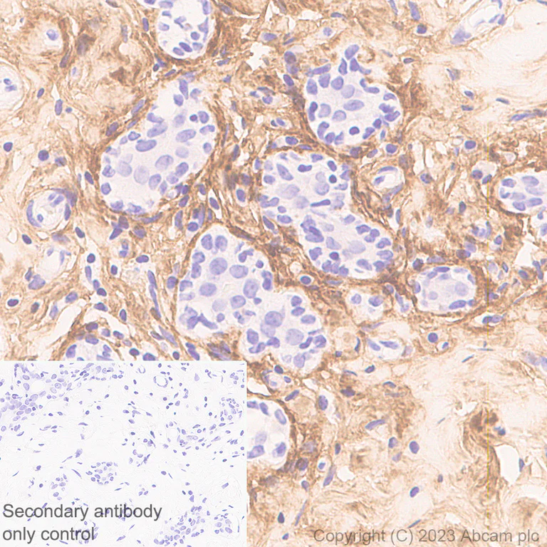 Immunohistochemistry (Formalin/PFA-fixed paraffin-embedded sections) - Anti-Periostin antibody [RM1074] (AB315104)