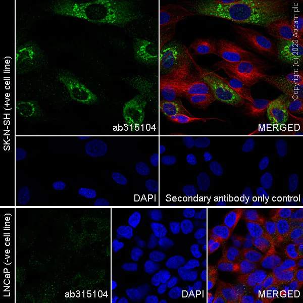 Immunocytochemistry/ Immunofluorescence - Anti-Periostin antibody [RM1074] - BSA and Azide free (AB315105)