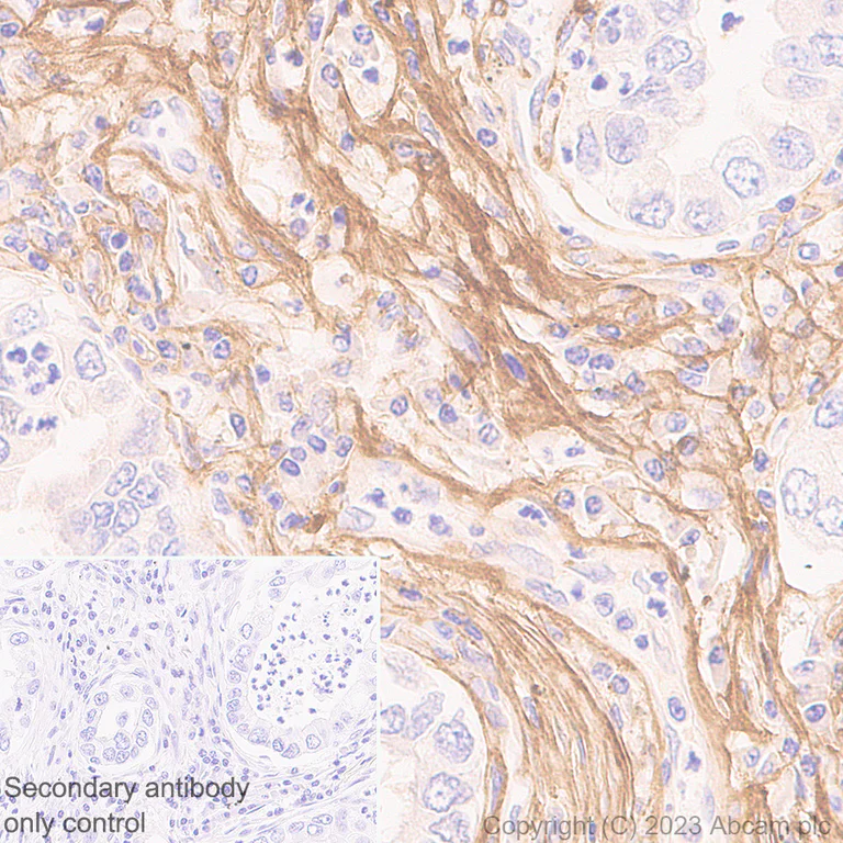Immunohistochemistry (Formalin/PFA-fixed paraffin-embedded sections) - Anti-Periostin antibody [RM1074] - BSA and Azide free (AB315105)