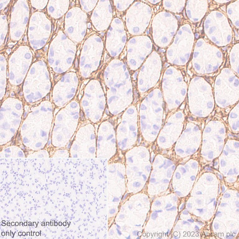 Immunohistochemistry (Formalin/PFA-fixed paraffin-embedded sections) - Anti-Periostin antibody [RM1074] - BSA and Azide free (AB315105)