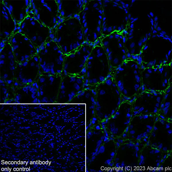 Immunohistochemistry (Frozen sections) - Anti-Periostin antibody [RM1074] - BSA and Azide free (AB315105)