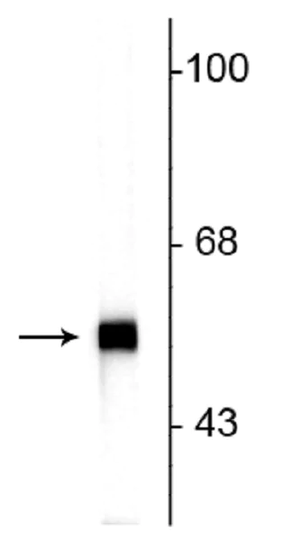 Western blot - Anti-Peripherin antibody [7C5] (AB254137)