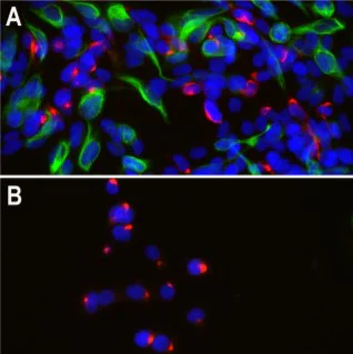 Immunocytochemistry/ Immunofluorescence - Anti-Peripherin antibody [8G2] (AB4653)