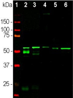 Western blot - Anti-Peripherin antibody [8G2] (AB4653)