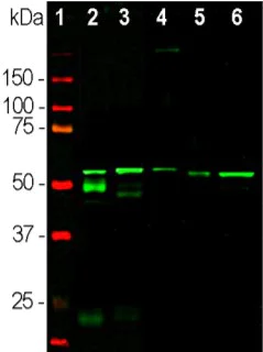 Western blot - Anti-Peripherin antibody [8G2] (AB4653)