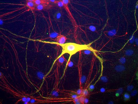 Immunocytochemistry/ Immunofluorescence - Anti-Peripherin antibody (AB254138), expandable thumbnail
