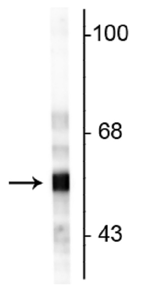 Western blot - Anti-Peripherin antibody (AB254138), expandable thumbnail