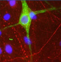 Immunocytochemistry/ Immunofluorescence - Anti-Peripherin antibody (AB39374)