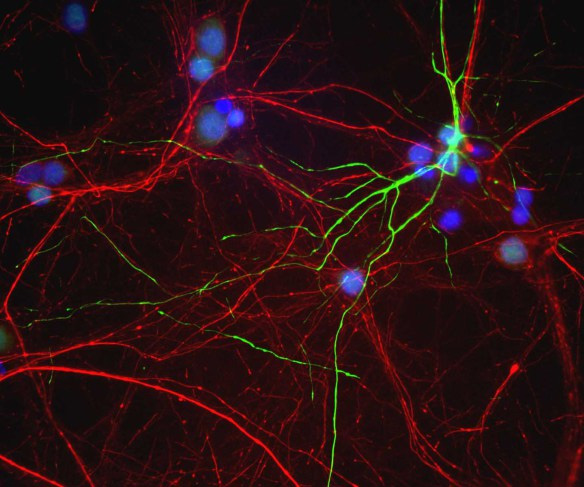 Immunocytochemistry/ Immunofluorescence - Anti-Peripherin antibody (AB4666), expandable thumbnail
