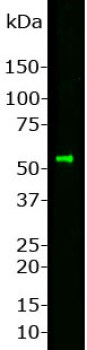 Western blot - Anti-Peripherin antibody (AB4666), expandable thumbnail
