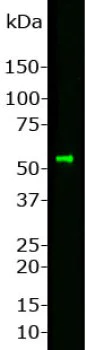 Western blot - Anti-Peripherin antibody (AB4666)