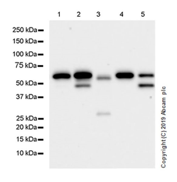 Western blot - Anti-Peripherin antibody [EPR23445-28] (AB246502)