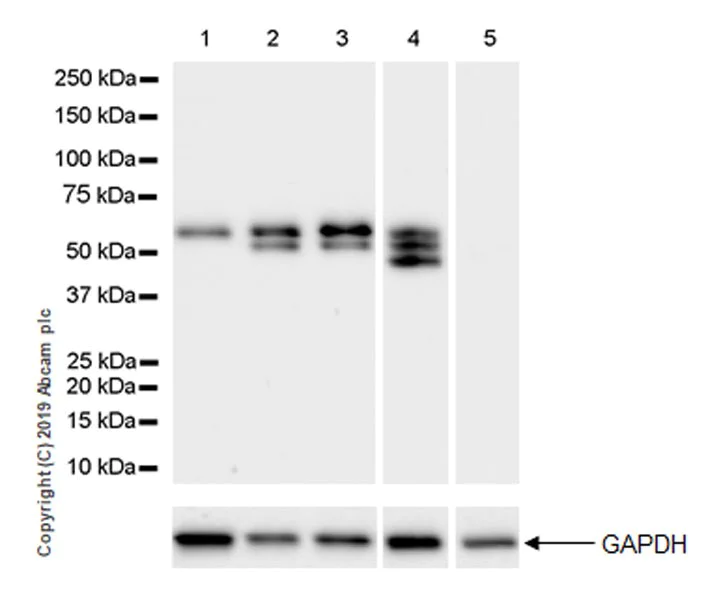 Western blot - Anti-Peripherin antibody [EPR23445-28] (AB246502)