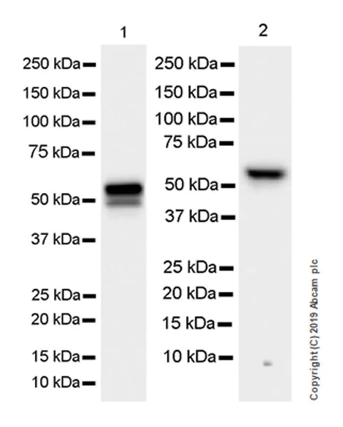 Western blot - Anti-Peripherin antibody [EPR23445-28] (AB246502)