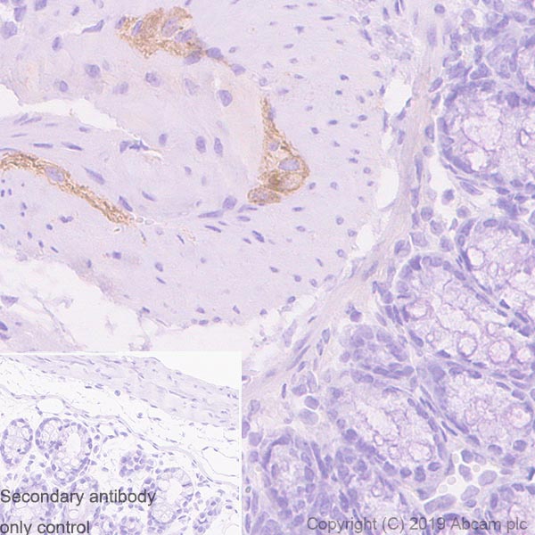 Immunohistochemistry (Formalin/PFA-fixed paraffin-embedded sections) - Anti-Peripherin antibody [EPR23445-28] - BSA and Azide free (AB269861), expandable thumbnail