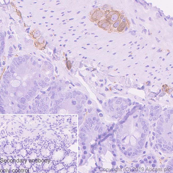 Immunohistochemistry (Formalin/PFA-fixed paraffin-embedded sections) - Anti-Peripherin antibody [EPR23445-28] - BSA and Azide free (AB269861), expandable thumbnail