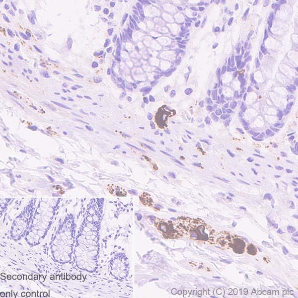 Immunohistochemistry (Formalin/PFA-fixed paraffin-embedded sections) - Anti-Peripherin antibody [EPR23445-28] - BSA and Azide free (AB269861), expandable thumbnail