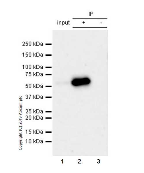 Immunoprecipitation - Anti-Peripherin antibody [EPR23445-28] - BSA and Azide free (AB269861), expandable thumbnail