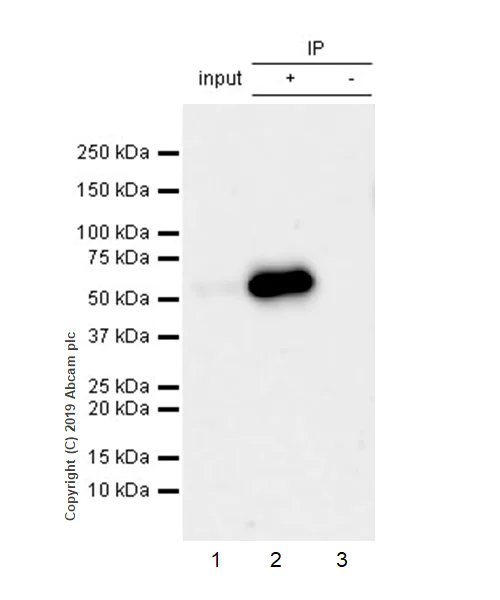 Immunoprecipitation - Anti-Peripherin antibody [EPR23445-28] - BSA and Azide free (AB269861)