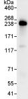 Immunoprecipitation - Anti-Periplakin antibody (AB72422)