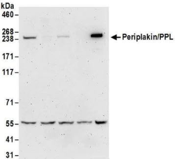 Western blot - Anti-Periplakin antibody (AB72422)