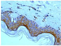 Immunohistochemistry (Formalin/PFA-fixed paraffin-embedded sections) - Anti-Periplakin antibody [EPR8296] (AB131269)