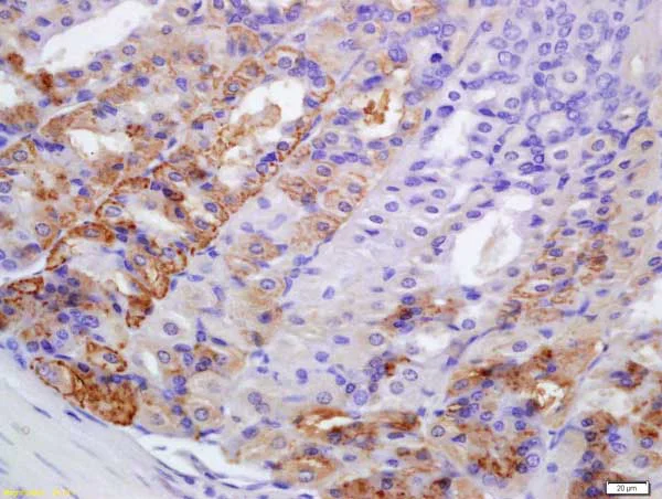 Immunohistochemistry (Formalin/PFA-fixed paraffin-embedded sections) - Anti-PERK antibody (AB217322)