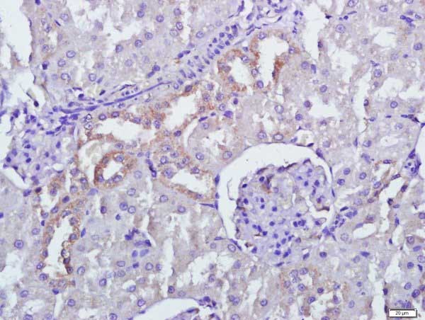 Immunohistochemistry (Formalin/PFA-fixed paraffin-embedded sections) - Anti-PERK antibody (AB217322), expandable thumbnail