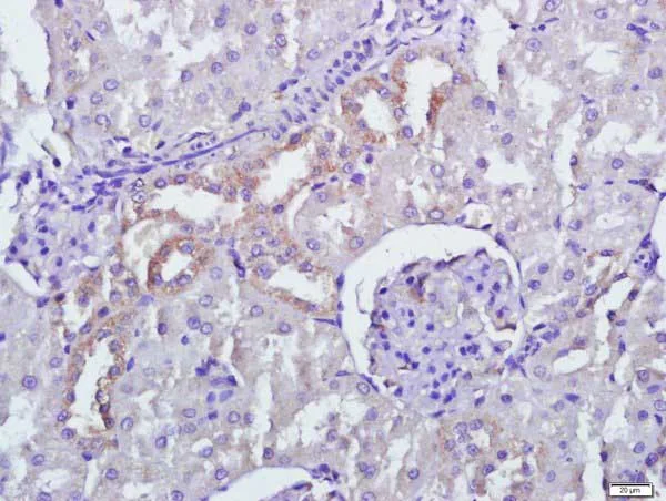 Immunohistochemistry (Formalin/PFA-fixed paraffin-embedded sections) - Anti-PERK antibody (AB217322)