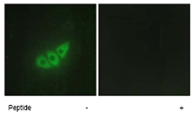 Immunocytochemistry/ Immunofluorescence - Anti-PERK antibody (AB65142), expandable thumbnail