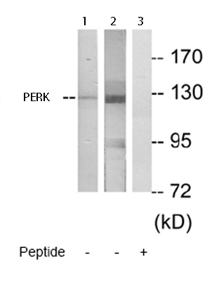 Western blot - Anti-PERK antibody (AB65142), expandable thumbnail