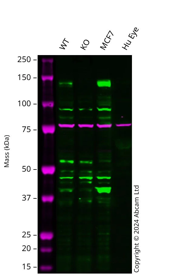Western blot - Anti-PERK antibody (AB65142)