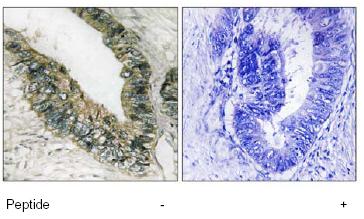 Immunohistochemistry (Formalin/PFA-fixed paraffin-embedded sections) - Anti-PERK antibody (AB79483)