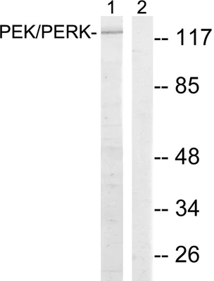 Western blot - Anti-PERK antibody (AB79483)