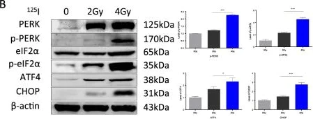Western blot - Anti-PERK antibody (AB79483)
