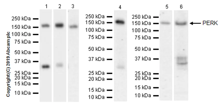 Western blot - Anti-PERK antibody [EPR19876-294] (AB229912)