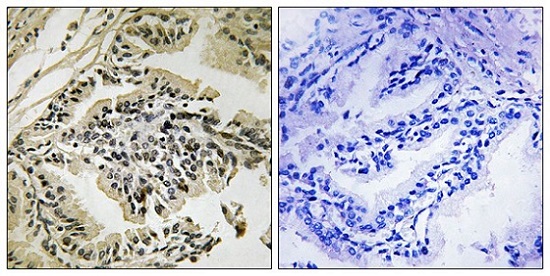 Immunohistochemistry (Formalin/PFA-fixed paraffin-embedded sections) - Anti-PERK (phospho T982) antibody (AB192591)