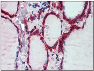 Immunohistochemistry (Formalin/PFA-fixed paraffin-embedded sections) - Anti-Peroxiredoxin 1/PAG antibody (AB109766), expandable thumbnail