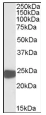 Western blot - Anti-Peroxiredoxin 1/PAG antibody (AB109766)