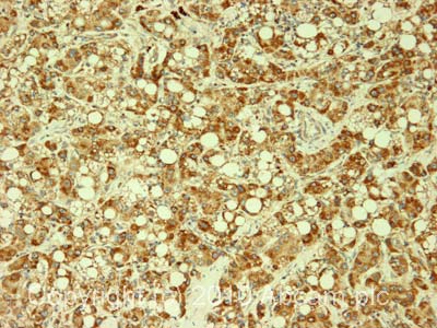 Immunohistochemistry (Formalin/PFA-fixed paraffin-embedded sections) - Anti-Peroxiredoxin 1/PAG antibody (AB15571), expandable thumbnail