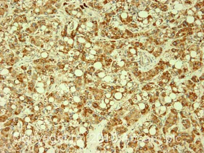 Immunohistochemistry (Formalin/PFA-fixed paraffin-embedded sections) - Anti-Peroxiredoxin 1/PAG antibody (AB15571)