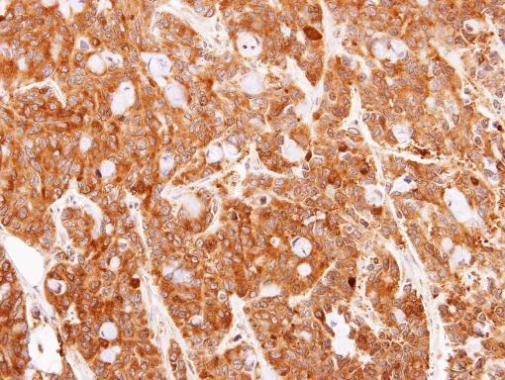 Immunohistochemistry (Formalin/PFA-fixed paraffin-embedded sections) - Anti-Peroxiredoxin 1/PAG antibody (AB228780)