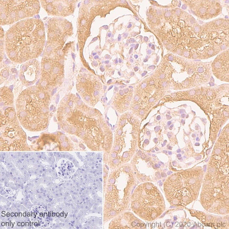 Immunohistochemistry (Formalin/PFA-fixed paraffin-embedded sections) - Anti-Peroxiredoxin 1/PAG antibody [EPR5433] - BSA and Azide free (AB247879), expandable thumbnail