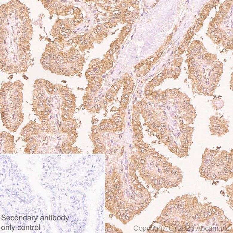 Immunohistochemistry (Formalin/PFA-fixed paraffin-embedded sections) - Anti-Peroxiredoxin 1/PAG antibody [EPR5433] - BSA and Azide free (AB247879), expandable thumbnail